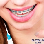 elgydium-clinic-trio-compact-interdental-2.jpg